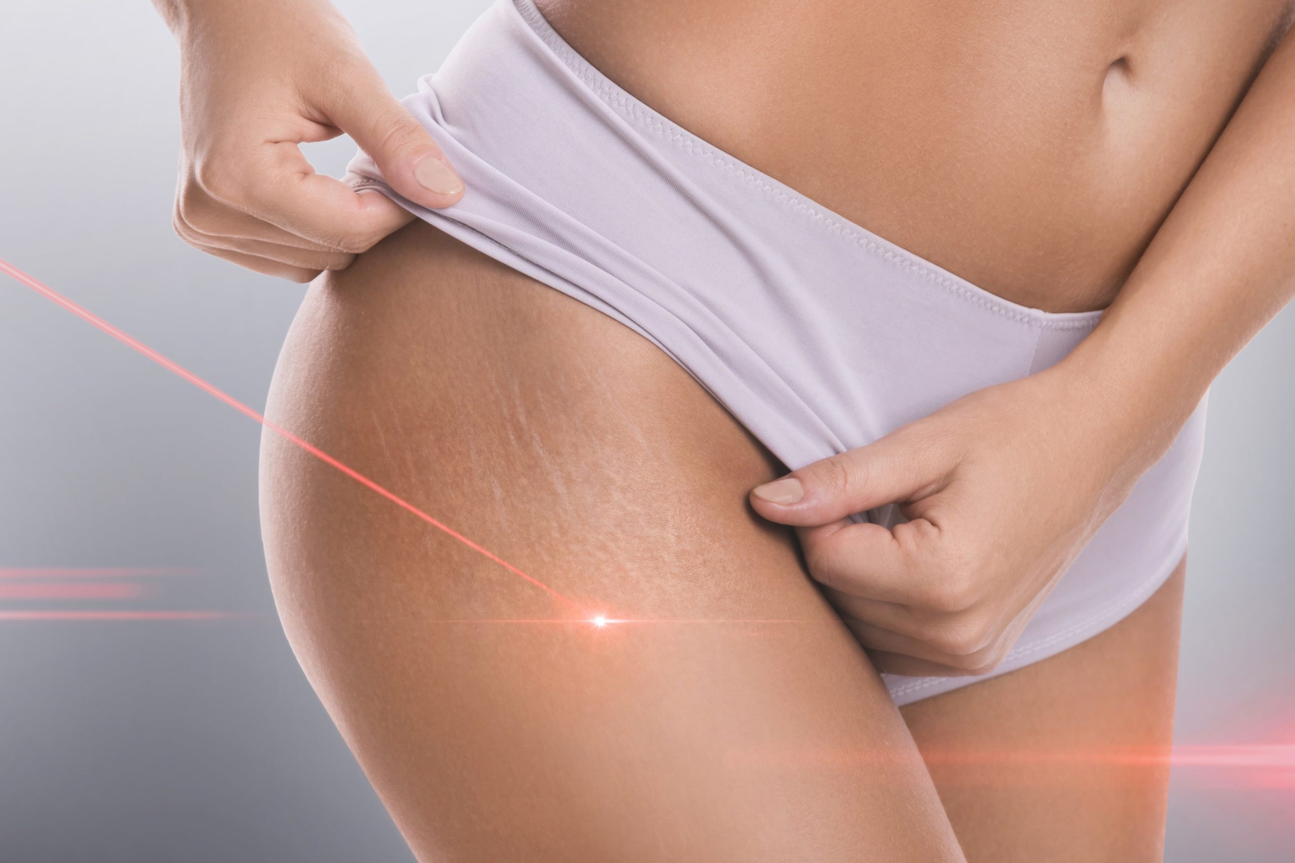 What Is Chrome Laser Treatment, And Will It Work To Improve Skin Texture
