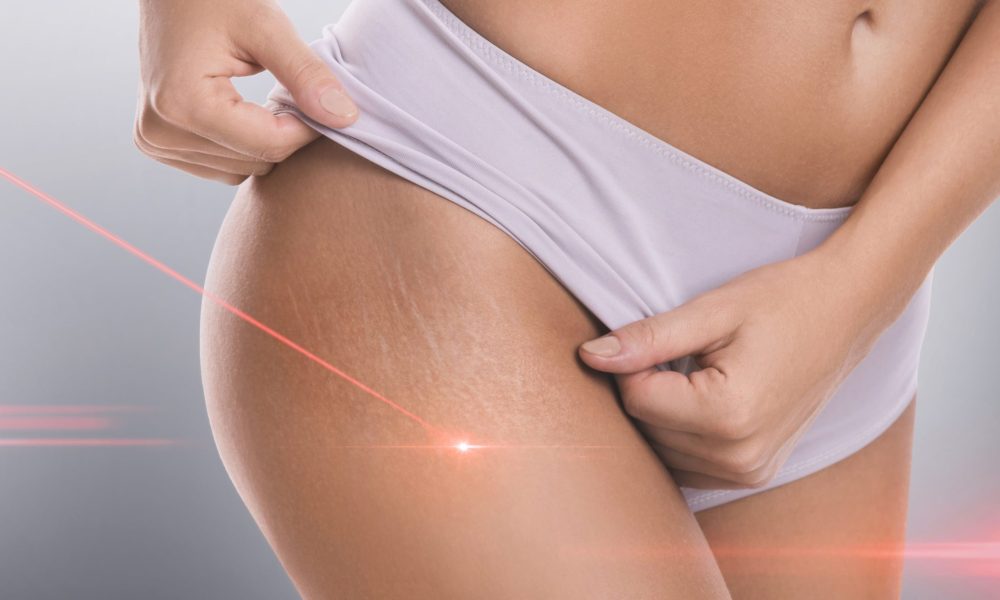 What Is Chrome Laser Treatment, And Will It Work To Improve Skin Texture